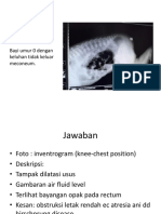 Adiobonam Ujian Tulis Akhir Copy