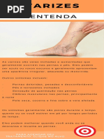 Varizes - Dr. Alexandre Amato