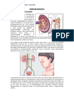 Articulo 4 Sindrome Nefrotico