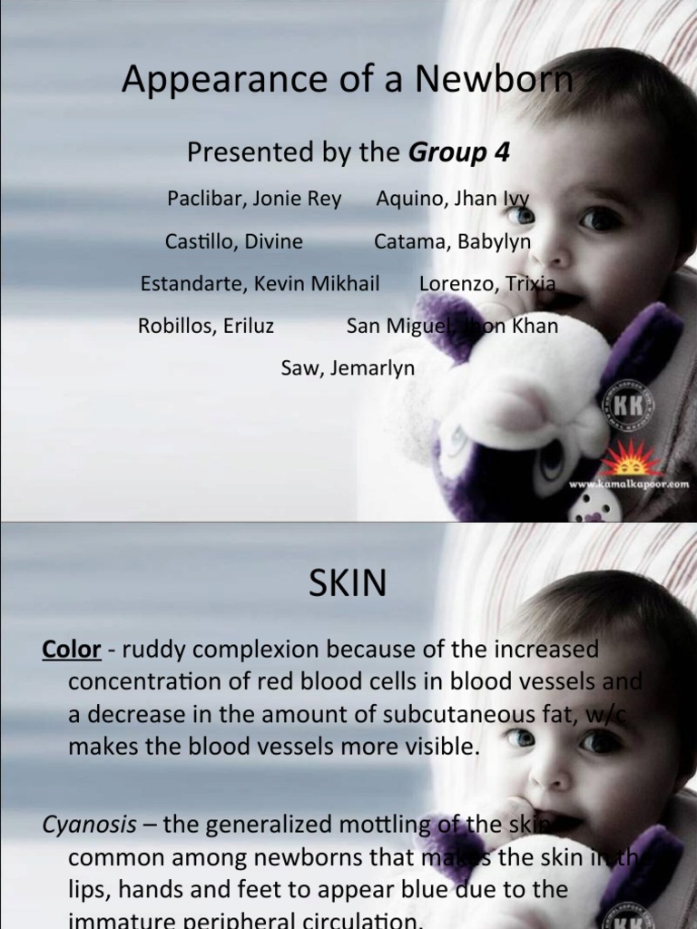 Appearance of A Newborn: Presented by The Group 4 | PDF | Skull | Anatomy