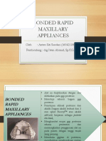 Bonded Rapid Maxillary Appliances