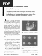 Download A Stent for Pre Surgical Evaluation of Implant by kadrology SN42442824 doc pdf