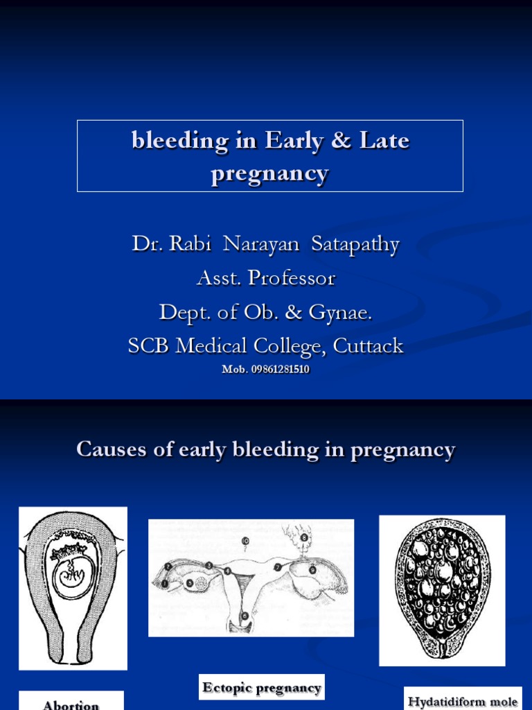 Early and Late Pregnancy Bleeding Causes | PDF | Miscarriage | Women's ...