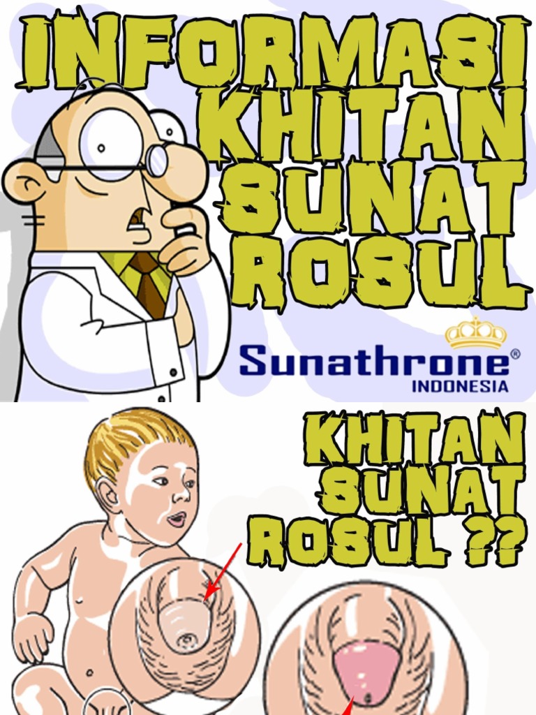 Info Sunat Anak Sunathrone Id | PDF