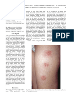Contact Nummular (Discoid) Eczema From Depilating Cream: Case Report