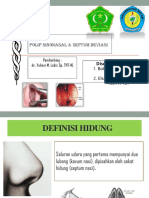 Polip Sinonasal+septum Deviasi