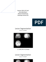 USC Keck Internship Report on Brain Image Analysis