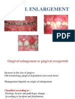 Gingival Enlargement