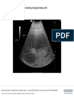 Thickened Cortex.: Fig. 1. Ultrasound Scan Demonstrating Enlarged Kidney With