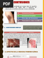 Clasificación de Contusiones Simples y Complejas | PDF | Enfermedades y ...