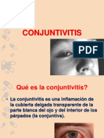 CONJUNTIVITIS