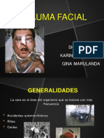 Fractura de Hueso Malar y Arco Cigomático