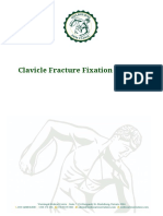Clavicle Fracture Fixation Protocol