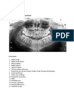 Interpretasi Radiografi Panoramik