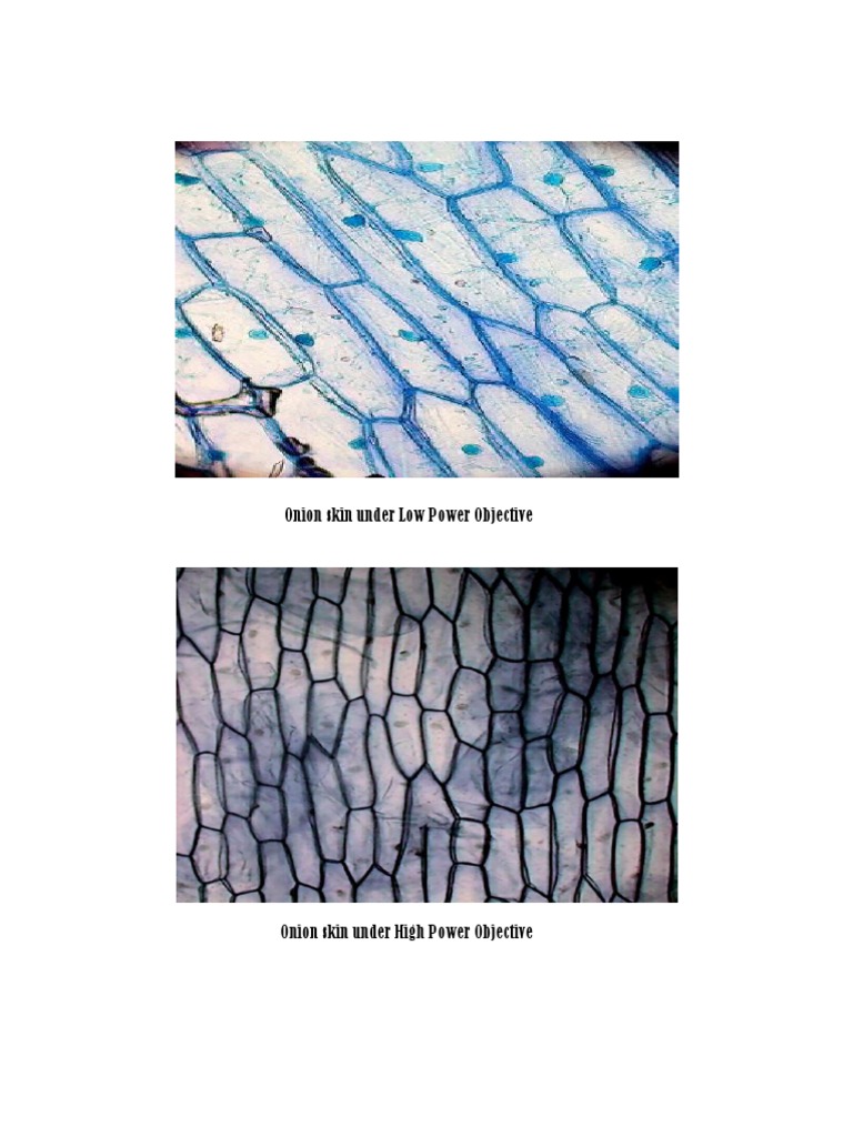 Onion Skin Under Low Power Objective PDF