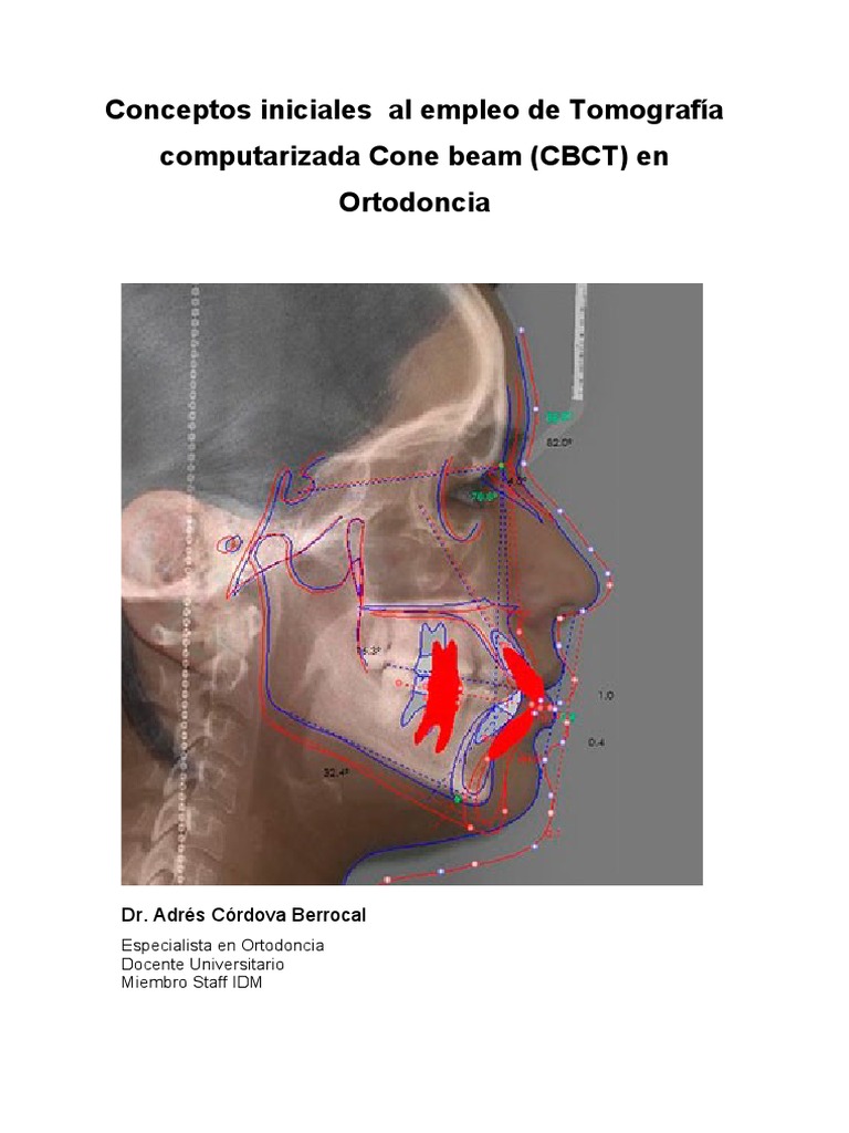 IDM Tomografia Computarizada Cone Beam Andres Cordova | PDF | Ct Scan ...