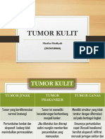 Tumor Kulit