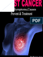 Breast Cancer Signs, Symptoms, Causes, Prevent and Treatment