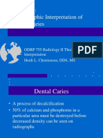 Radiographic Interpretation of Dental Caries: ODRP 755 Radiology II Theory & Interpretation Heidi L. Christensen, DDS, MS