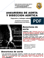 Aneurisma de Aorta