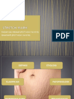 Stretch Mark