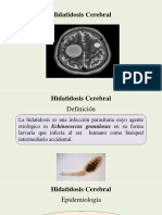 Hidatidosis