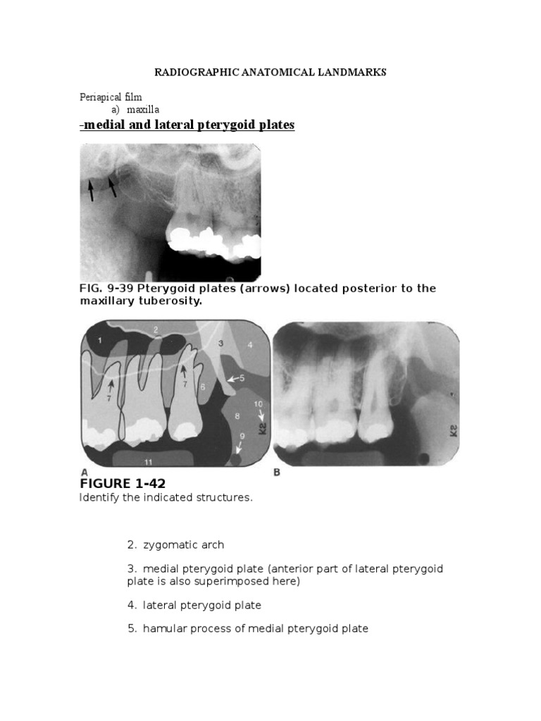 Hamular Process