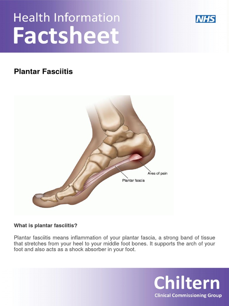 Patient Leaflet Plantar Fasciitis PDF PDF Foot Lower Limb Anatomy