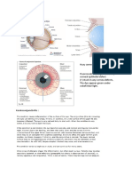 Atopic Keratoconjuctivitis