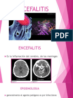 Encefalitis-causas-sintomas