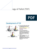 Tetralogy of Fallot (TOF)