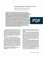 The Cantilever Fixed Partial Denture-A Literature Review: Forces and Stress Distribution