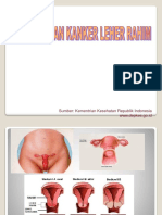 Ppt Kanker Serviks - Fix