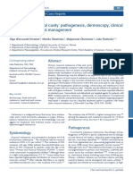 Melanoma of The Oral Cavity: Pathogenesis, Dermoscopy, Clinical Features, Staging and Management