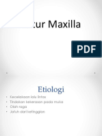 Maxillar and Mandibular Fracture-dr. Ismail