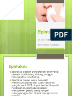 Epistaksis.pptx