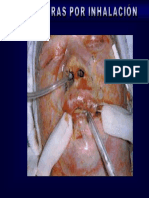 Quemaduras Por Inhalación PDF