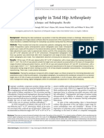 Digital Radiography in Total Hip Arthroplasty