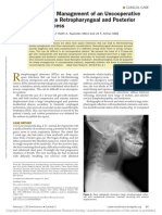 Emergent Airway Management of An Uncooperative Child With A Large Retropharyngeal and Posterior Mediastinal Abscess