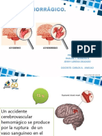 ACV Hemorragico