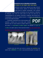 Aspectos radiográficos das alterações periapicais