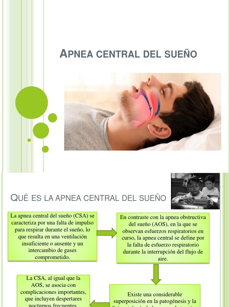 Características y diagnóstico de la apnea del sueño – Serbinter