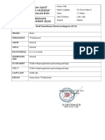 Hasil Pemeriksaan Electrocardiogram Geisa