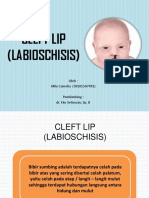 210 - Lip Cleft (Schwartz)