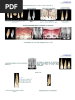 Anatomia Interna 2_Dentes
