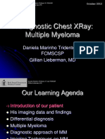 A Diagnostic Chest Xray: Multiple Myeloma: Daniela Marinho Tridente, Vi FCMSCSP Gillian Lieberman, MD