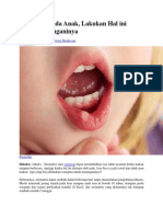 Stomatitis Pada Anak