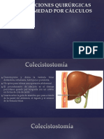 Tratamiento Quirurgico de La Ictericia Obstructiva