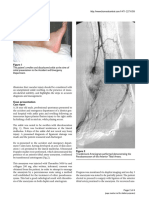 Pseudo-Aneurysm of The Anterior Tibial Artery 2