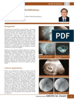 Percutaneous Nephrolithotomy: Background